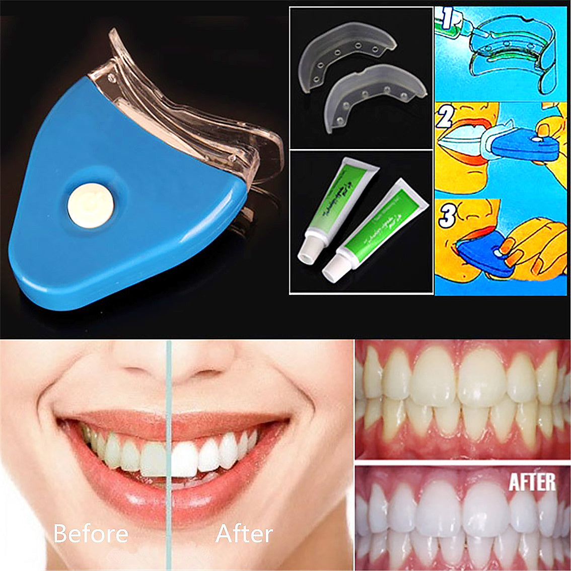 Blanqueador dental con luz led